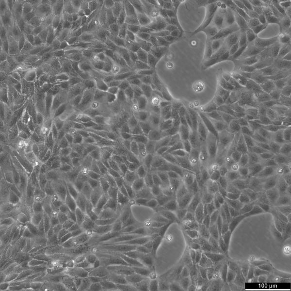 MDCK-II cell