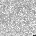MEL-JUSO cell