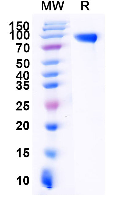 Recombinant Mouse EGFR/ERBB1/HER1 Protein, C-His