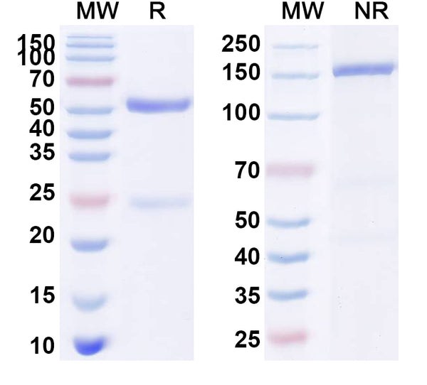 SDS-PAGE for Anti-Mouse EGFR/ERBB1 Antibody (SAA2220)