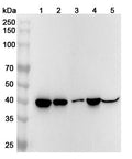 Western blot analysis was performed using anti-ADA  polyclonal antibody at ADA  on various samples.
Lane 1: Jurkat cell lysate
Lane 2: MOLT-4 cell lysate
Lane 3: Mouse thymus lysate
Lane 4: Mouse stomach lysate
Lane 5: Rat spleen lysate