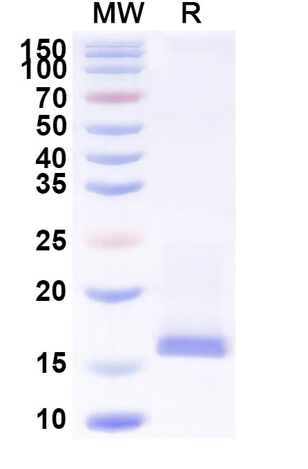 Recombinant Mouse CST3 Protein, C-His