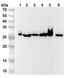 Western blot analysis was performed using anti-CA1 polyclonal antibody at CA1 on various samples.
Lane 1: Mouse spleen lysate
Lane 2: Rat spleen lysate
Lane 3: Mouse lung lysate
Lane 4: Rat lung lysate
Lane 5: Mouse colon lysate
Lane 6: Rat brain lysate