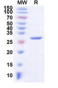 Recombinant Mouse CRP Protein, N-His