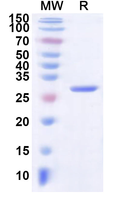Recombinant Mouse CRP Protein, N-His