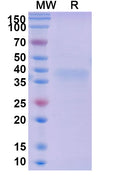 Recombinant Mouse LAYN/Layilin Protein, C-His