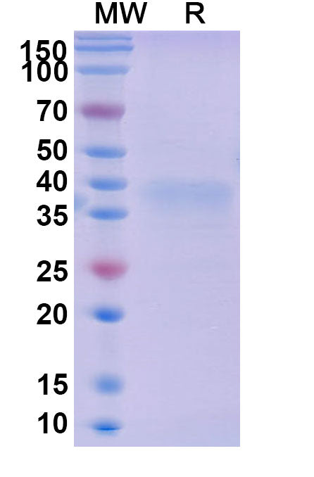 Recombinant Mouse LAYN/Layilin Protein, C-His