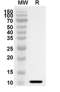 Western blot analysis was performed using anti-Mouse DKK1 polyclonal antibody at 1ug/mL on recombinant Mouse DKK1 (Catalog No. MF914012).