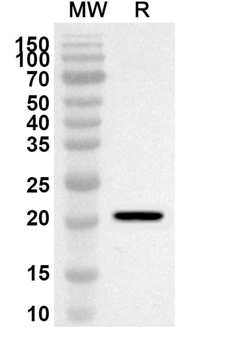 Western blot analysis was performed using anti-Mouse CREG1 polyclonal antibody at 1ug/mL on recombinant Mouse CREG1 (Catalog No. MF961012).