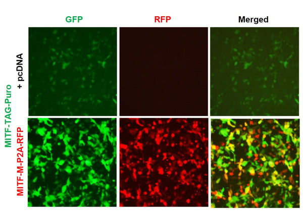 MITF Reporter Lentivirus – Figure 1