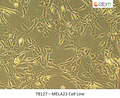 MELA23 Cell Line | Applied Biological Materials (abm)