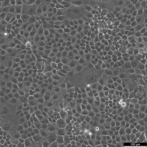 MKN-74 cell