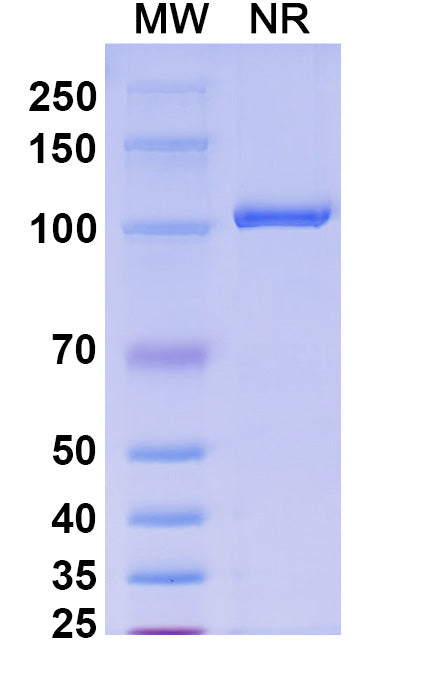 SDS-PAGE for Anti-Mouse H2-Ab1/MHCII Antibody (H2-Ab1).