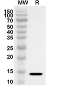 Western blot analysis was performed using anti-Mouse TIMD4/TIM-4 polyclonal antibody at 1ug/mL on recombinant Mouse TIMD4/TIM-4 (Catalog No. MP042012).