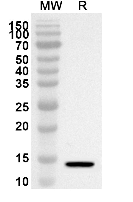 Western blot analysis was performed using anti-Mouse TIMD4/TIM-4 polyclonal antibody at 1ug/mL on recombinant Mouse TIMD4/TIM-4 (Catalog No. MP042012).
