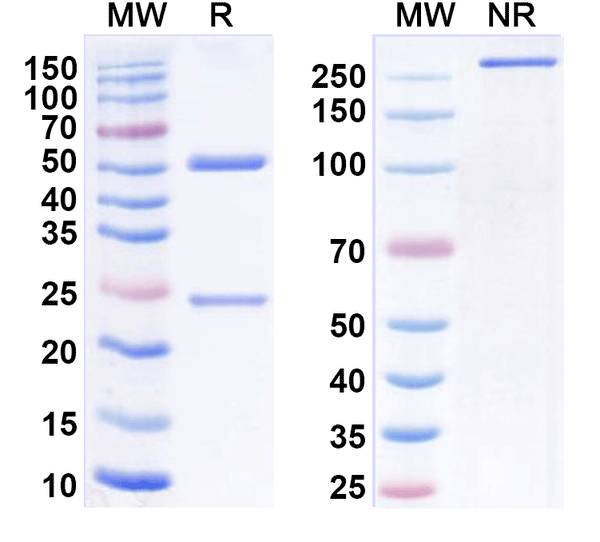 SDS-PAGE for Anti-Mouse TIMD4/TIM-4 Antibody (RMT4-53)