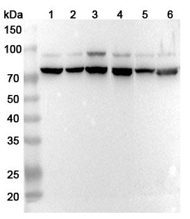 Western blot analysis was performed using anti-VSIG1 polyclonal antibody at 1ug/mL  on various samples.
Lane 1: BxPC-3 cell lyssate
Lane 2: SGC-7901 cell lysate
Lane 3: MCF-7 cell lysate
Lane 4: Mouse testis lysate
Lane 5: Rat testis lysate
Lane 6: Rat ovary lysate