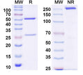 SDS-PAGE for Anti-Mouse EHF/ESE-3 Monoclonal Antibody (1A145)
