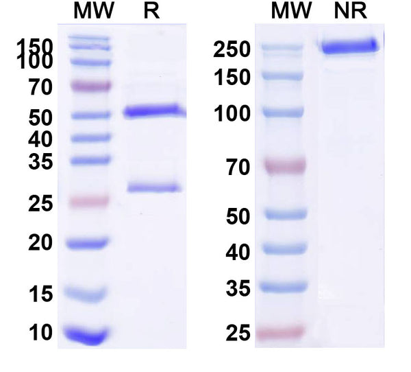 SDS-PAGE for Anti-Mouse TCR Vβ?8 Antibody (F23.1)