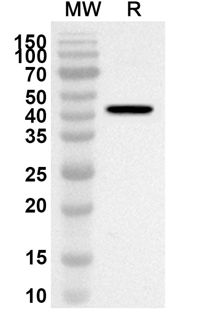 Western blot analysis was performed using anti-Mouse Reg3b polyclonal antibody at 1ug/mL on recombinant Mouse Reg3b (Catalog No. MP424012).