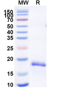 Recombinant Mouse MYDGF Protein, N-His