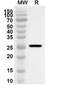 Western blot analysis was performed using anti-Mouse SFRP2 polyclonal antibody at 1ug/mL on recombinant Mouse SFRP2 (Catalog No. MP620012).