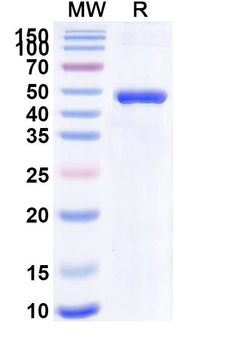 Recombinant Mouse IL4I1 Protein, N-His
