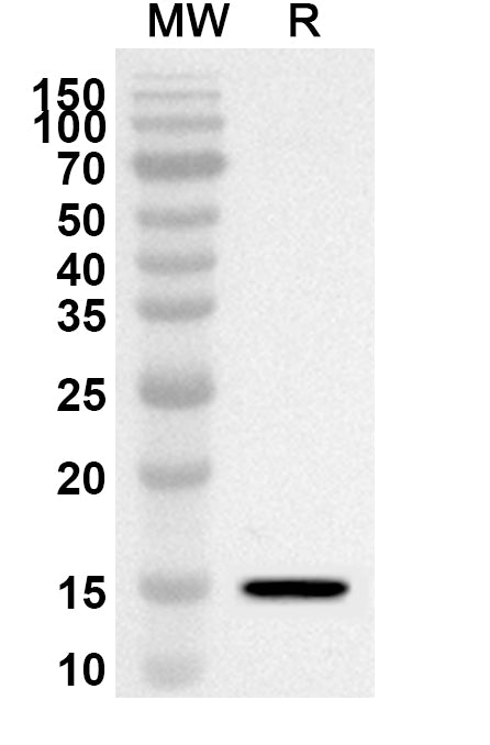 Western blot analysis was performed using anti-Mouse Mbl1 polyclonal antibody at 1ug/mL on recombinant Mouse Mbl1 (Catalog No. MP768012).