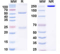 SDS-PAGE for Anti-Mouse KIRREL3/NEPH2 Antibody (N321C/49R)