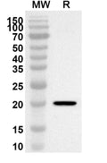 Western blot analysis was performed using anti-Mouse TRBC1 polyclonal antibody at 1ug/mL on recombinant Mouse TRBC1 (Catalog No. MP894012).