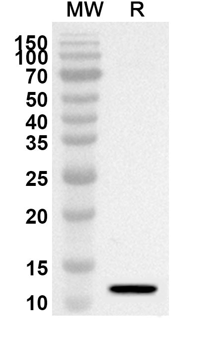 Western blot analysis was performed using anti-Mouse FRZB polyclonal antibody at 1ug/mL on recombinant Mouse FRZB (Catalog No. MP920012).
