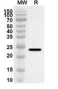Western blot analysis was performed using anti-Mouse ULBP1 polyclonal antibody at 1ug/mL on recombinant Mouse ULBP1 (Catalog No. MP921012).