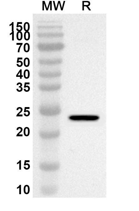 Western blot analysis was performed using anti-Mouse ULBP1 polyclonal antibody at 1ug/mL on recombinant Mouse ULBP1 (Catalog No. MP921012).