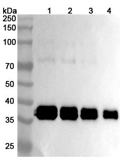 Western blot analysis was performed using anti-LY6E/SCA-2 monoclonal antibody at 1μg/ml on various samples.
Lane 1: recombinant human LY6E/SCA-2 (Catalog No: HS714011), 50ng
Lane 2: recombinant human LY6E/SCA-2 (Catalog No: HS714011), 30ng
Lane 3: recombinant human LY6E/SCA-2 (Catalog No: HS714011), 20ng
Lane 4: recombinant human LY6E/SCA-2 (Catalog No: HS714011), 10ng