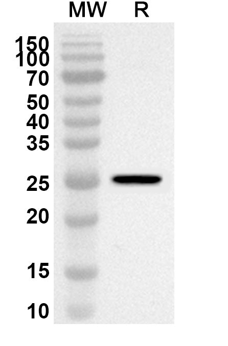Western blot analysis was performed using anti-Mouse ECM1 polyclonal antibody at 1ug/mL on recombinant Mouse ECM1 (Catalog No. MS793012).