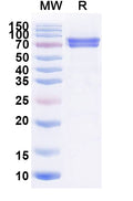 Recombinant Mouse CA9 Protein, C-Fc