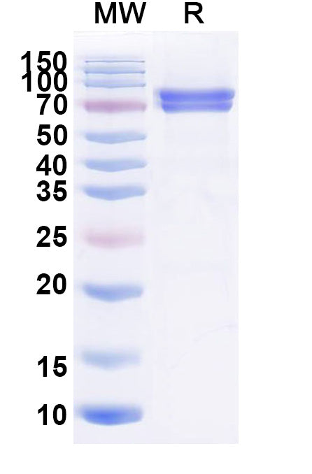 Recombinant Mouse CA9 Protein, C-Fc