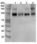 Western blot analysis was performed using anti-NTRK2 polyclonal antibody at 1µg/ml on various samples.
Lane 1: Mouse brain lysate
Lane 2: Mouse cerebellum lysate
Lane 3: Rat brain lysate
Lane 4: Rat cerebellum lysate
