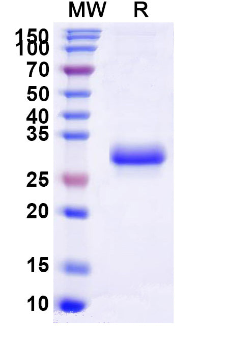 Recombinant Mouse EFNB3 Protein, C-His