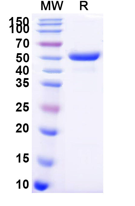 Recombinant Mouse EFNB3 Protein, C-Fc