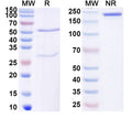 SDS-PAGE for Anti-Mouse ZNF423 Antibody (N328B/37R).