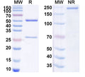 SDS-PAGE for Anti-Mouse IgE/IGHE Antibody (84.1C).