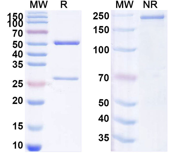 SDS-PAGE for Anti-Mouse IgE/IGHE Antibody (84.1C).