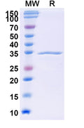 Recombinant Mouse COL17A1/Bp180 Protein, N-GST & C-His