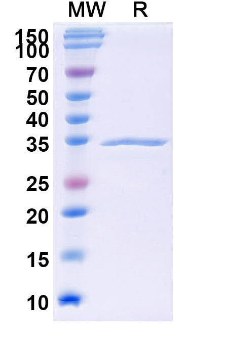Recombinant Mouse COL17A1/Bp180 Protein, N-GST & C-His