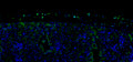 Mouse lung tissue section stained by immunofluorescence showing STING protein (green) predominantly in airway epithelial cells and scattered parenchymal cells, with nuclei counterstained by DAPI (blue).