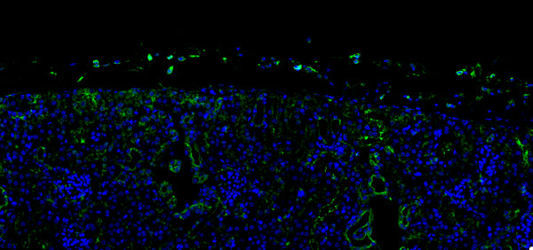 Mouse lung tissue section stained by immunofluorescence showing STING protein (green) predominantly in airway epithelial cells and scattered parenchymal cells, with nuclei counterstained by DAPI (blue).