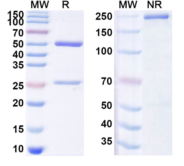 SDS-PAGE for Anti-Mouse IL-31RA/NR10 Antibody (SAA1987)