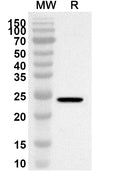 Western blot analysis was performed using anti-Mouse IL31RA polyclonal antibody at 1ug/mL on recombinant Mouse IL31RA (Catalog No. MV121012).