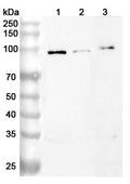 Western blot analysis was performed using anti-ACE2 polyclonal antibody at 1ug/mL on various samples.
Lane 1: Mouse testis lysate
Lane 2: Mouse lung lysate
Lane 3: Rat testis lysate